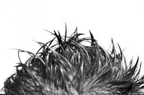 Scientists Make Hair-Growing Cells From Ordinary Skin Cells