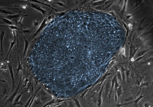 Many Promising Embryonic Stem Cell Therapies Ensnared In Legal Loophole