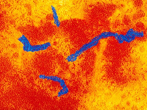 How We Used To Talk About Measles
