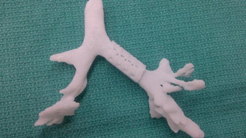 This 3-D Printed Bioplastic Windpipe Saved A Baby's Life
