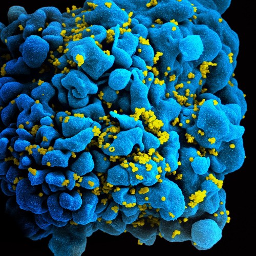 New Wearable Device Could Protect Against HIV and Pregnancy
