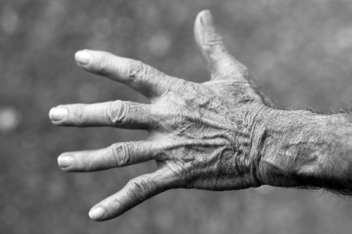 Is Getting Old A Disease?