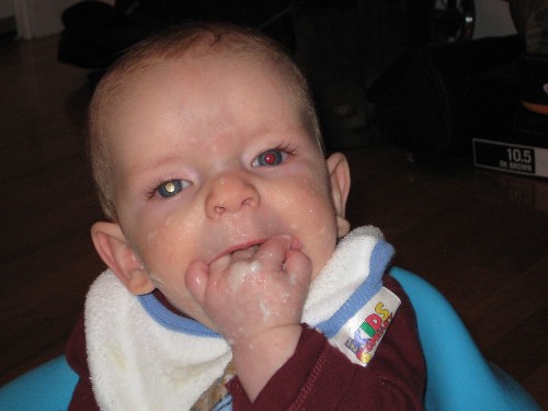 Baby Pics Can Diagnose Deadly Cancer
