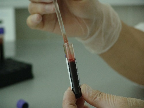 The FDA just approved a game-changing cancer treatment