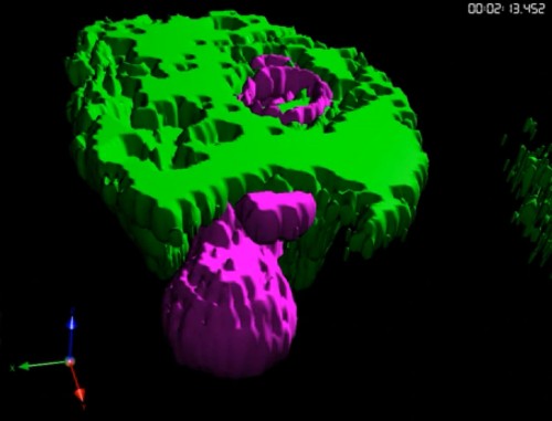 Parasitic Amoeba Eats People Alive, Bite By Bite