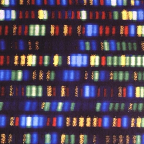Your Full Genome Can Be Sequenced and Analyzed For Just $1,000