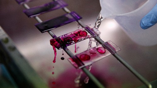 After gene-editing, Crispr’s new frontier to detect diseases is closer to becoming a reality