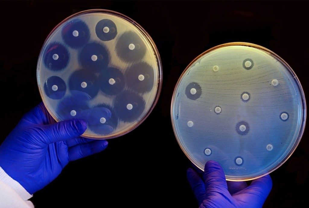 Phosphine gas, seen on Venus, is also produced by bacteria on Earth — but we don't know exactly how