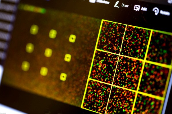Malicious code written into DNA infects the computer that reads it