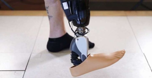 Brain-Powered Prosthetics Get Closer To Becoming An Everyday Reality
