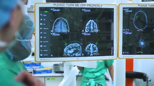 Alzheimer’s memories could be switched back on with implant
