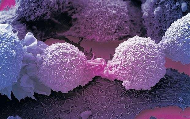 Cancer patients could have treatment chosen by computer rather than a doctor