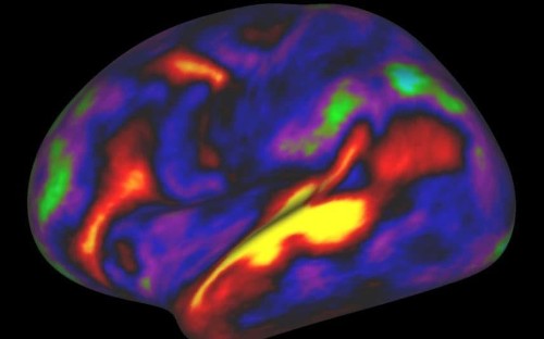 Generosity down to brain's wiring, new research suggests