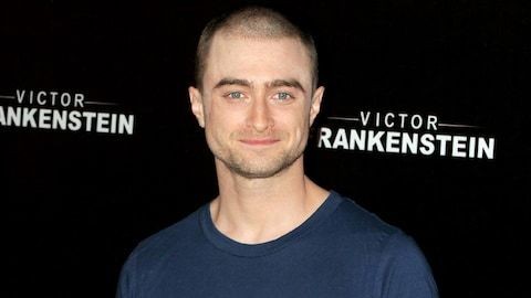 Daniel Radcliffe opens up about his post-Harry Potter drinking problem and that Trainwreck cameo