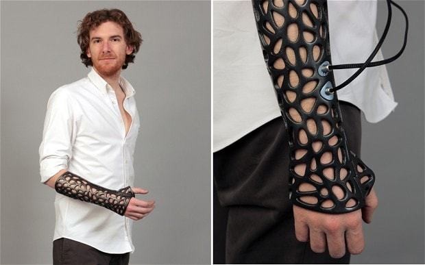 3D printed cast could heal bones 40 per cent faster
