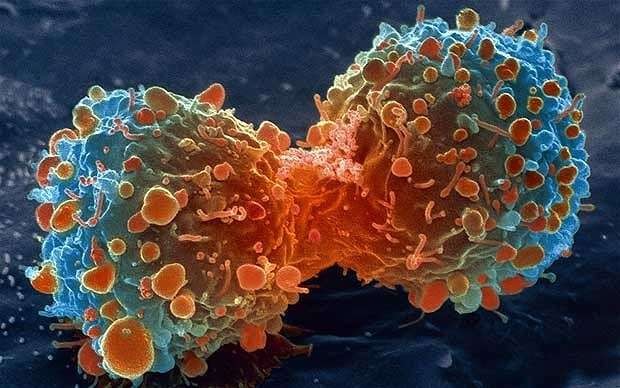 Cancer drug development time halved thanks to artificial intelligence