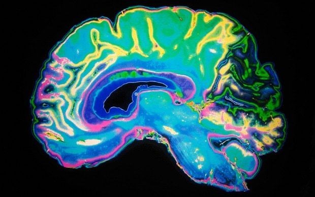 High childhood IQ linked to bipolar disorder later in life