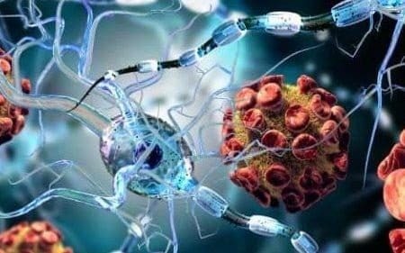 Stem cell treatment offers new hope for multiple sclerosis patients