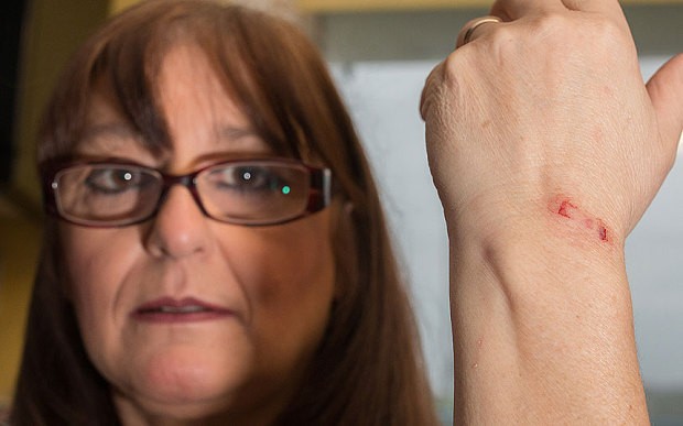 Violent pet rabbit 'Thugs Bunny' hospitalised a local resident and now has to endure pet psychiatry