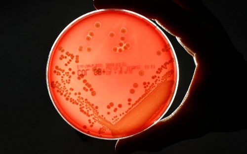 10 million lives could be lost to superbugs - so how far have we got in the race to beat them?