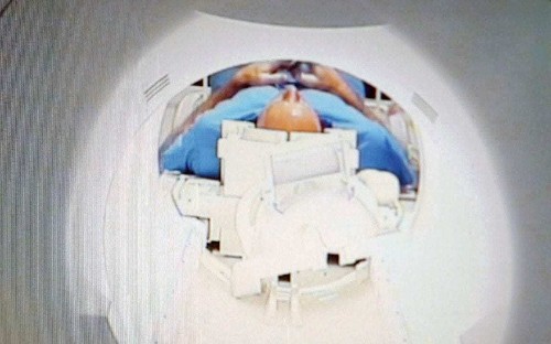 Magnetic 'metal seed' that destroys brain tumours in ten minutes invented by British scientists