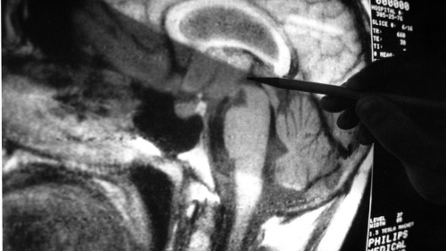Male and Female Brains Really Are Built Differently