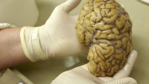 In the Brain, Memories Are Inextricably Tied to Place