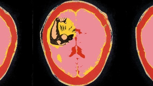 Power Causes Brain Damage