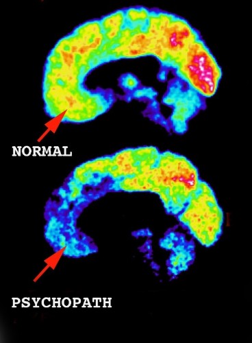 Life as a Nonviolent Psychopath