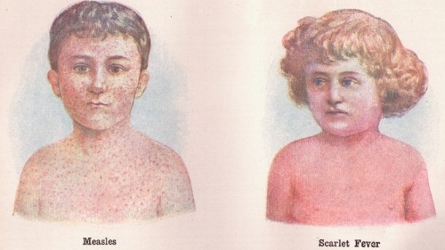 The New Measles