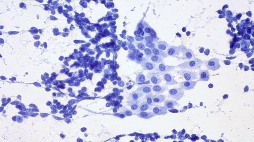 Can Doctors Teach the Body to Cure Cancer?