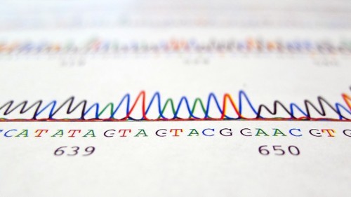 A Man Says His DNA Test Proves He’s Black, and He’s Suing