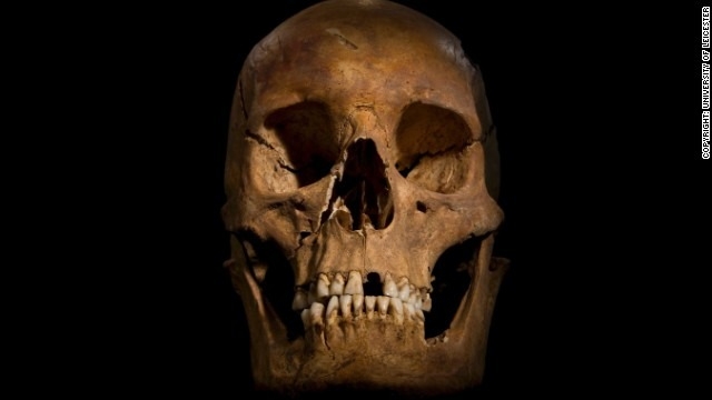 King Richard III's bones reveal fatal blows, scientists say