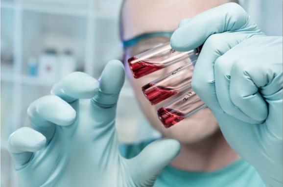 Why Silicon Valley must join the Ebola battle